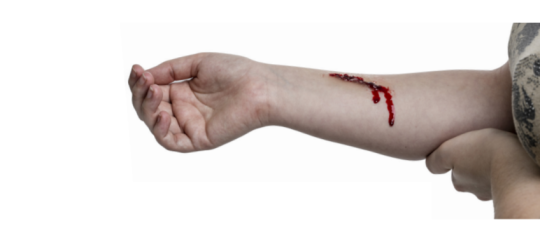 Eerste hulp bij bloedingen