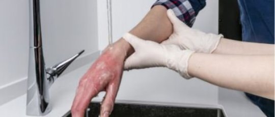 Eerste hulp bij brandwonden